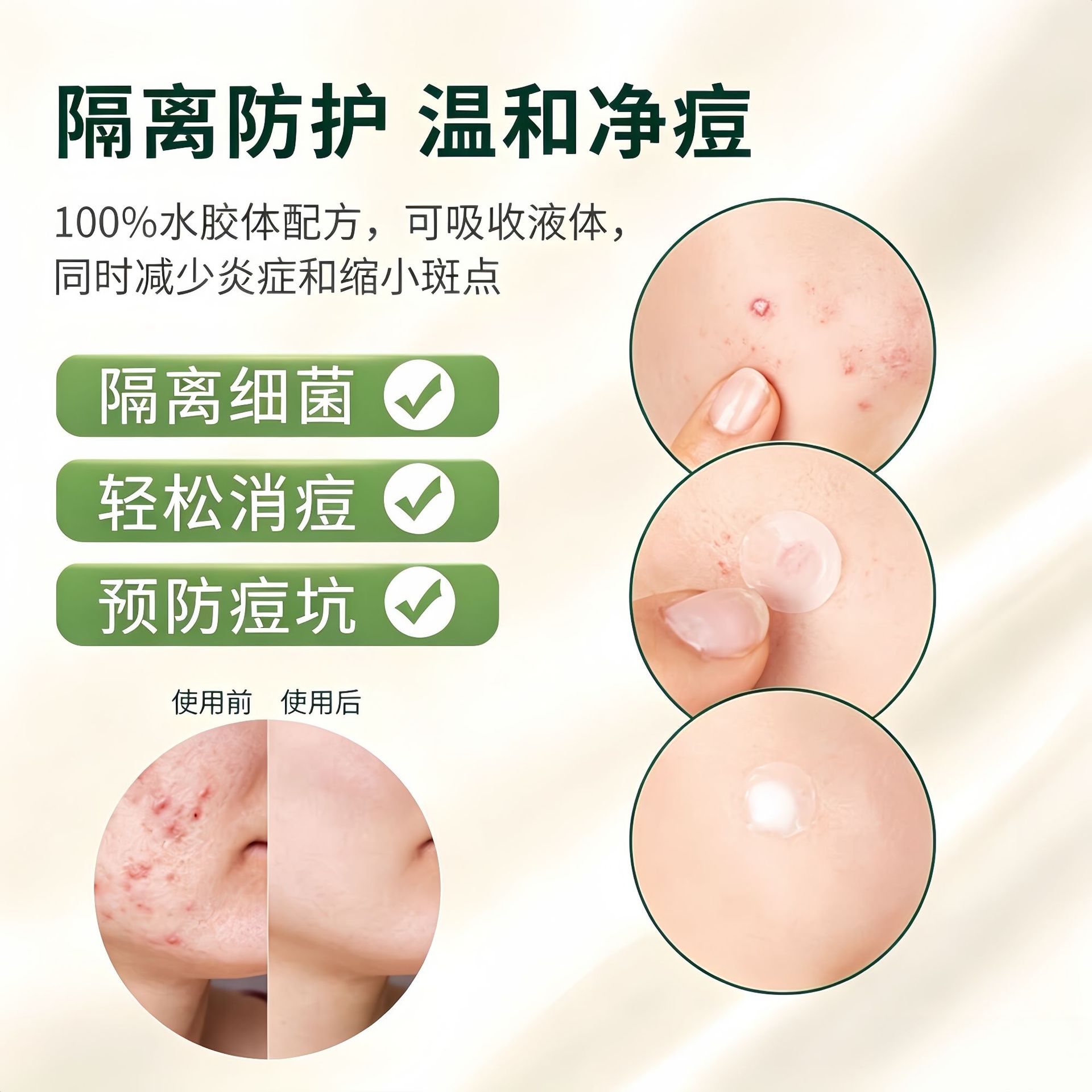 Cross-border wholesale colored star pimple patches acne concealer pus-absorbing portable spot cover invisible blemish stickers independently packaged