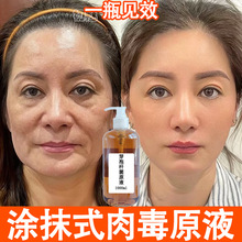 �TĨʽ�ⶾԭҺȥ����y̧�^�y���y�ⶾ�Uȥ���ⶾ�o�¿������AҺ