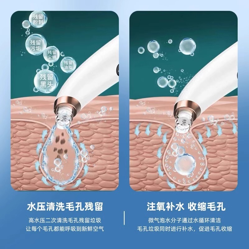 吸黑头神器小气泡注氧仪家用电动吸出粉刺脸部清洁美容仪补水可视|undefined