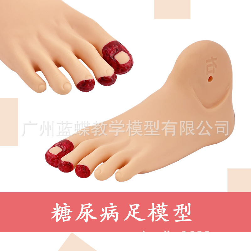 ���� ���㻤��ģ�� �㲿�� �� �����仯 �㲿�Ų����� PVC����