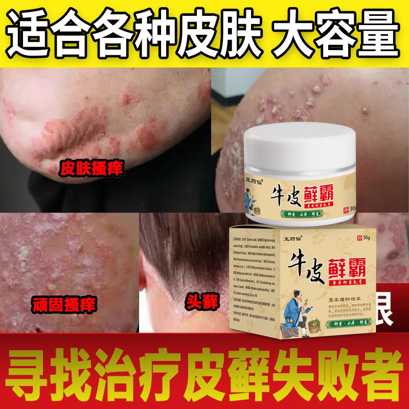 かゆみ止め王 銀含有 皮膚炎ケア かゆみ止めケア 卸売発送 体の痒み対策|undefined