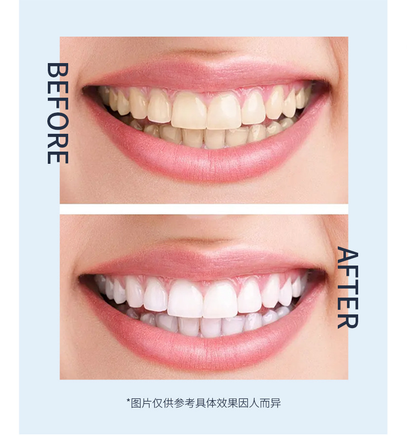 UUKKG Youyoumen Whitening Tooth Stain and Tobacco Stain Removal Toothpaste Freshening Breath Probiotic Refreshing Mint Toothpaste 100g undefined
