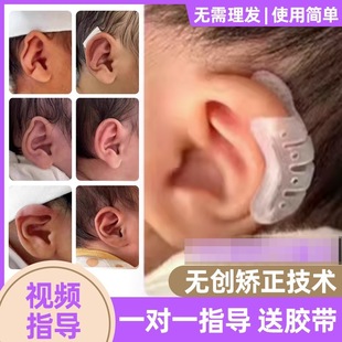 Baby auricle corrector baby ear corrector newborn ear deformity correction drop ear wind ear shaping fixation
