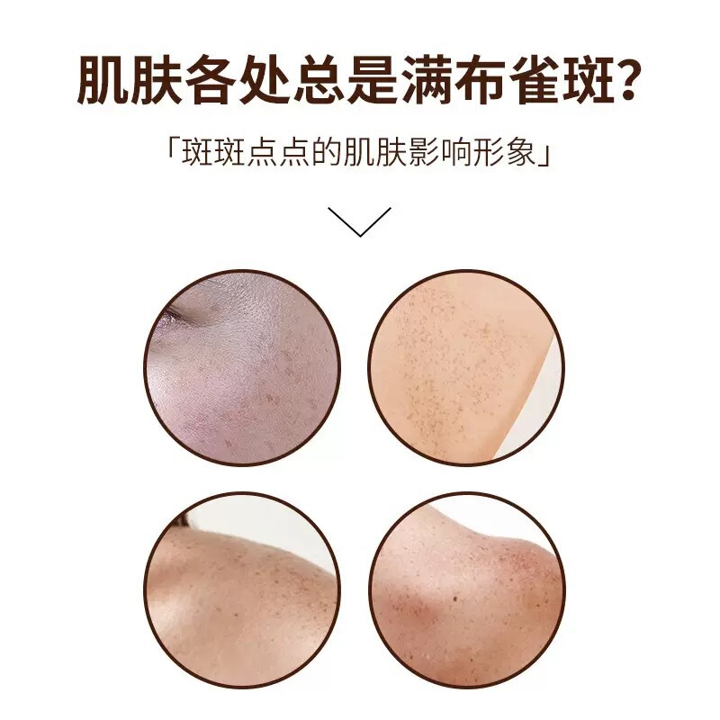 美容室専用恥ずかしくないそばかす抽出液、色除去液、そばかす分解色素そばかす除去液、スポットウォーター|undefined