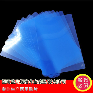 �t���zƬ��ī�{Ƭ�{����ʽ����ƴ�ӡ�zƬ���ƹ���X��Ƭ DR CR CT