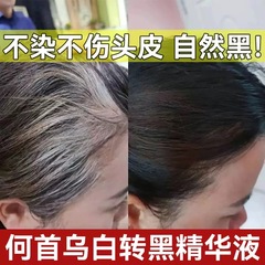白髪を黒髪に育てるエッセンス 黒霊芝とポリゴナム黒髪エッセンス 天然植物ヘア栄養液 ヘアケア