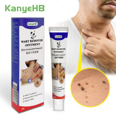 Kanyehb平猿尤はいぼのクリームを取り除きます。