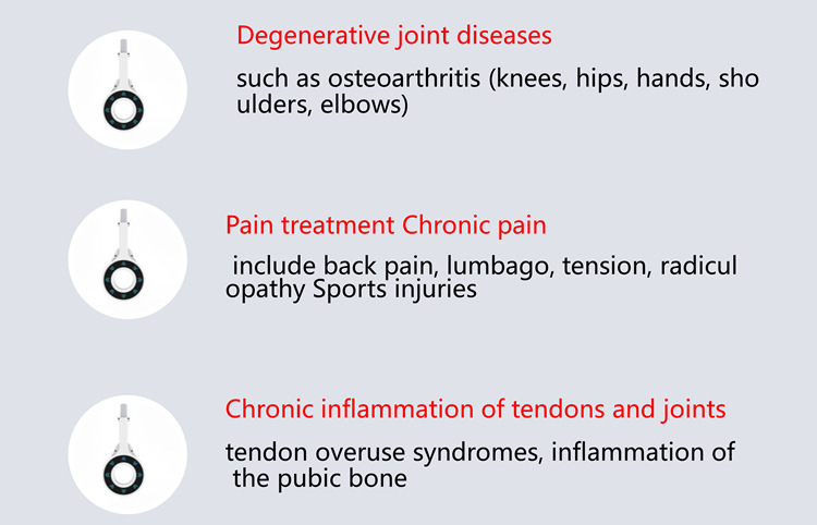 磁力环磁场超导身体关节疼痛理疗康复理疗仪