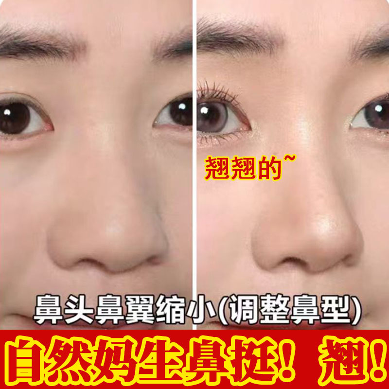 Nose Essential Oil Increasing Nose Bristal Solution Narrow Nose Aar Massage Essential Oil Tightening Nose Slim Nose Cream Nose Essence