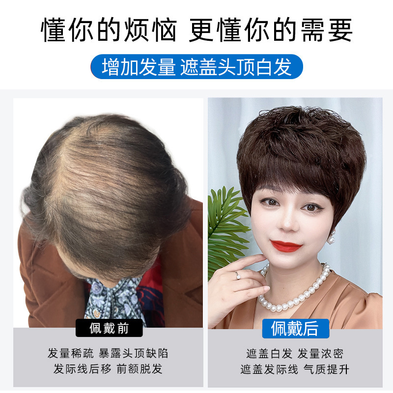 假发片女头顶短卷发妈妈中老年补发片真发遮白发仿真轻薄款假发女|undefined