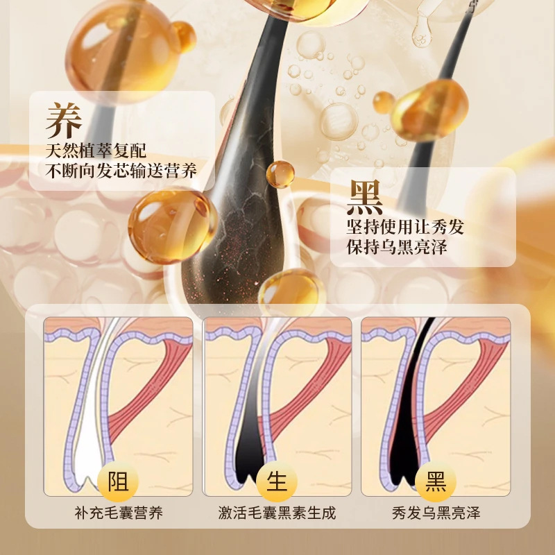 本物の高麗人参黒霊芝ポリゴナムシャンプー植物エキスヘアケアハーブシャンプーオイルコントロールシャンプー|undefined