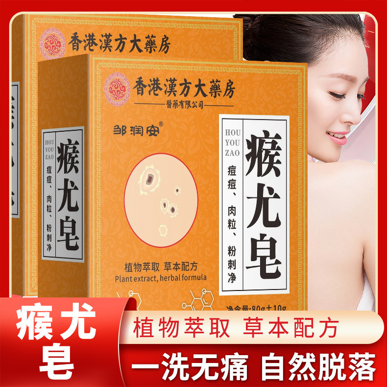 香港薬局の疣贅石鹸は全身に使用でき、痒みを和らげるために使用できます。猿の小さな肉粒をきれいにする手作り石鹸の卸売です。|undefined