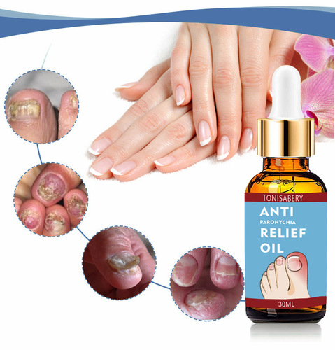 Anti-nail groove relief oil, soft nail polish, nail repair, ingrown toenail thickening, onychomycosis, nail groove care oil