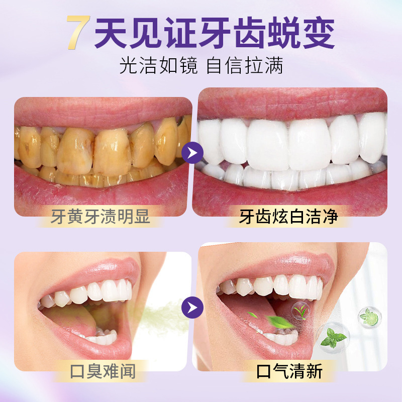 【到手2支牙膏】韩伦美羽美白去渍牙膏去黄口腔护理清新口气烟渍|undefined