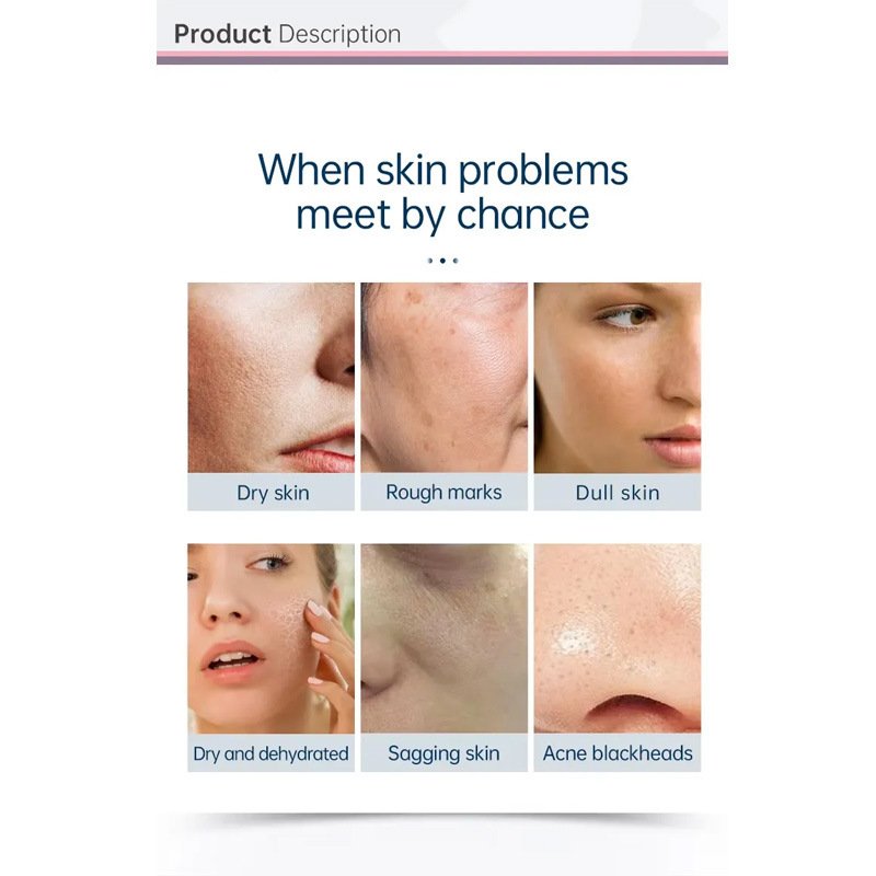 wface 6-in-1 Skin Hydra: Camera, Oxygen, Salon/SPA Gear|undefined