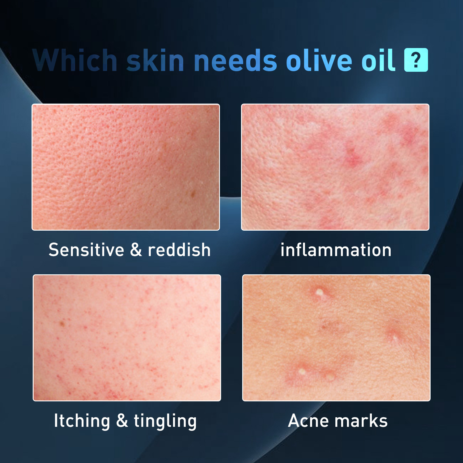 Essenza detergente per l'acne oligopeptidica da uomo: ottieni una pelle più chiara oggi stesso!_voghion.com