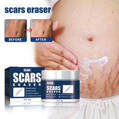 EELHOE Scar Fading Cream, Surgical Scar Fading Repair Cream, Cold Compress Burn Scar Cream, Skin Scar Gel Cream