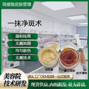 Whitening, Freehand Cleansing Spots, a Touch of Cleaning Spots, Beauty Salon Specializes in Chloasma, Dermal Spots, No Scab, No Peeling, Freckle Removal Cream