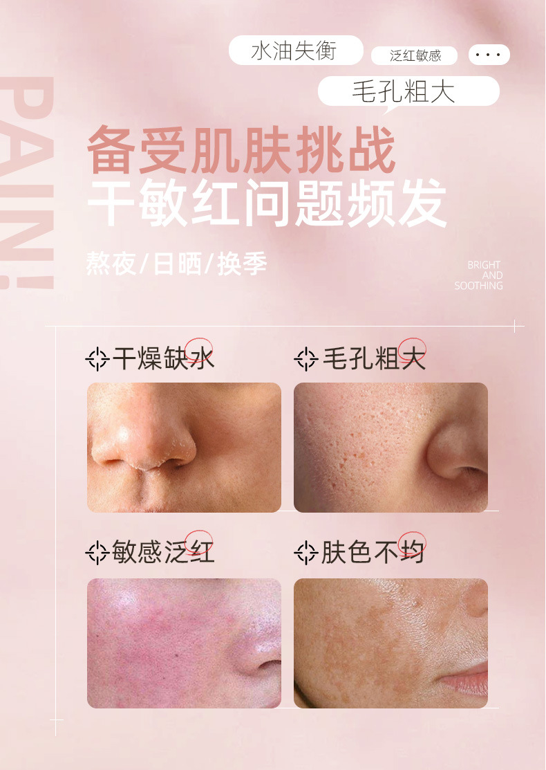 Fykly Rose Chamomile Flower Mask Improves Dullness Moisturizing Hydrating Mask Moisturizing Patch Mask Affordable