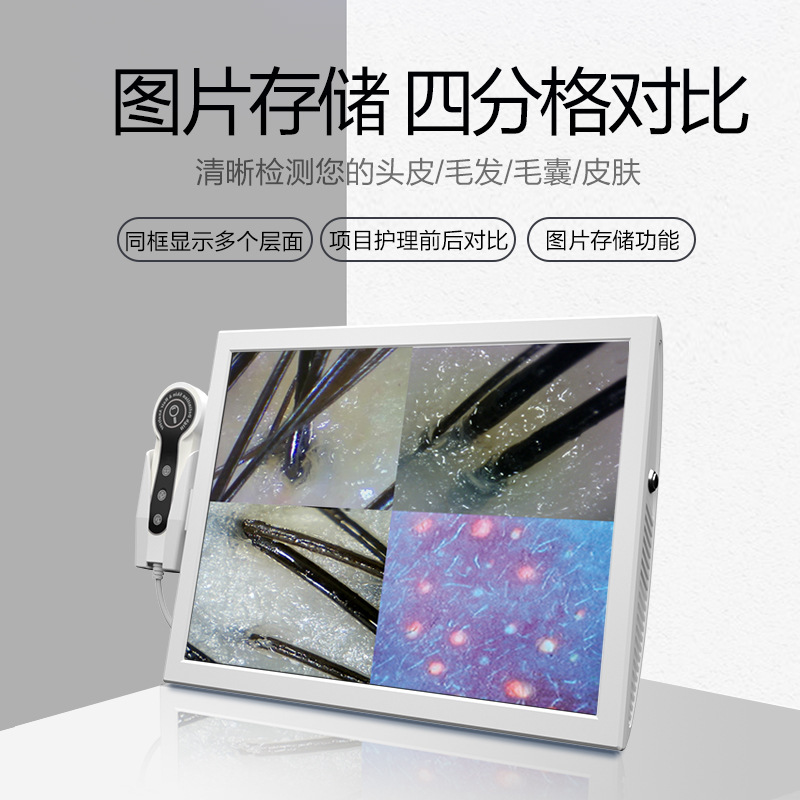 15inch with storage [200 times high definition + 50 times three spectrum]