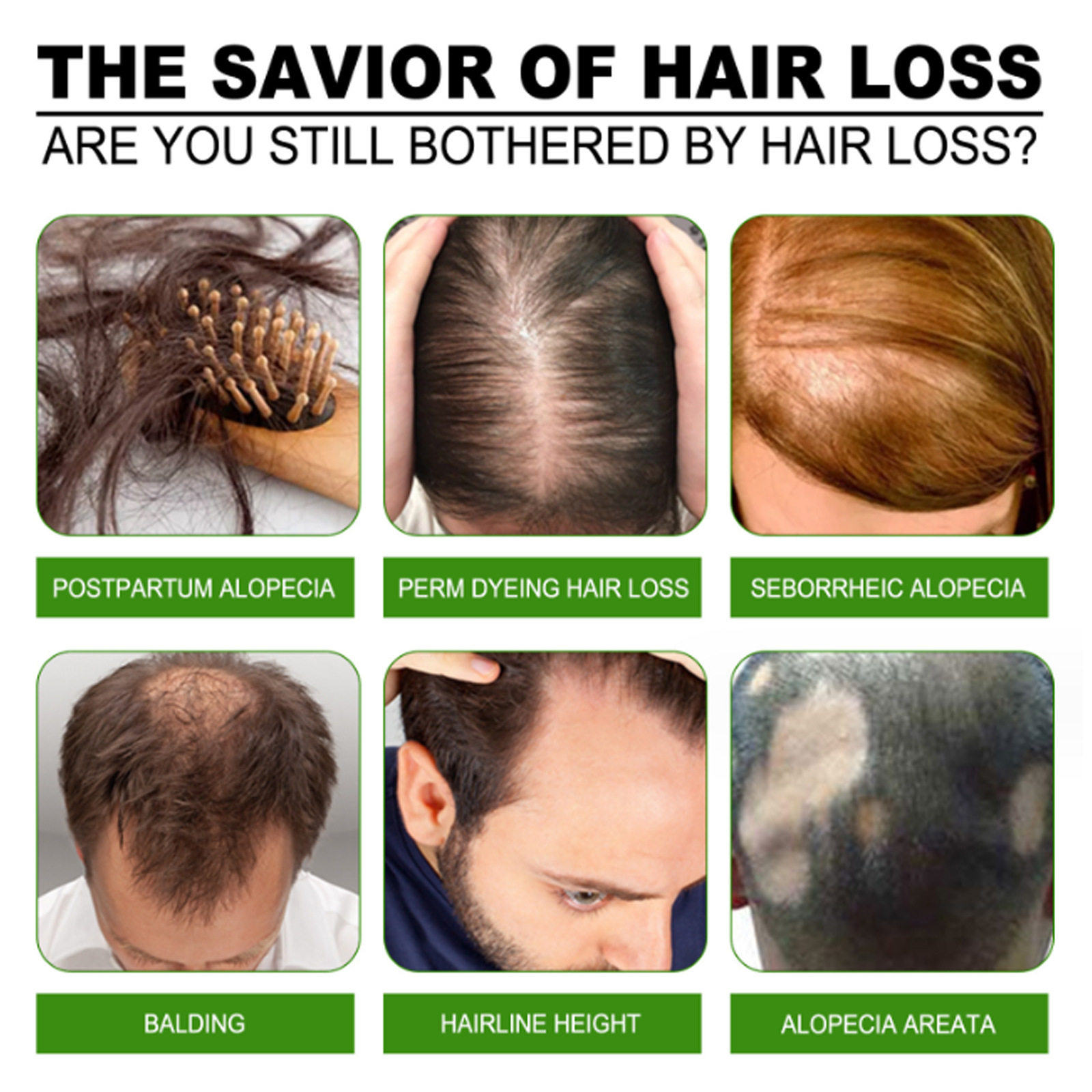 Dienvidmēness ingvera matu biezuma ēteriskā eļļa atjauno sausus, bojātus matus, novērš matu izkrišanu un stiprina matus._voghion.com