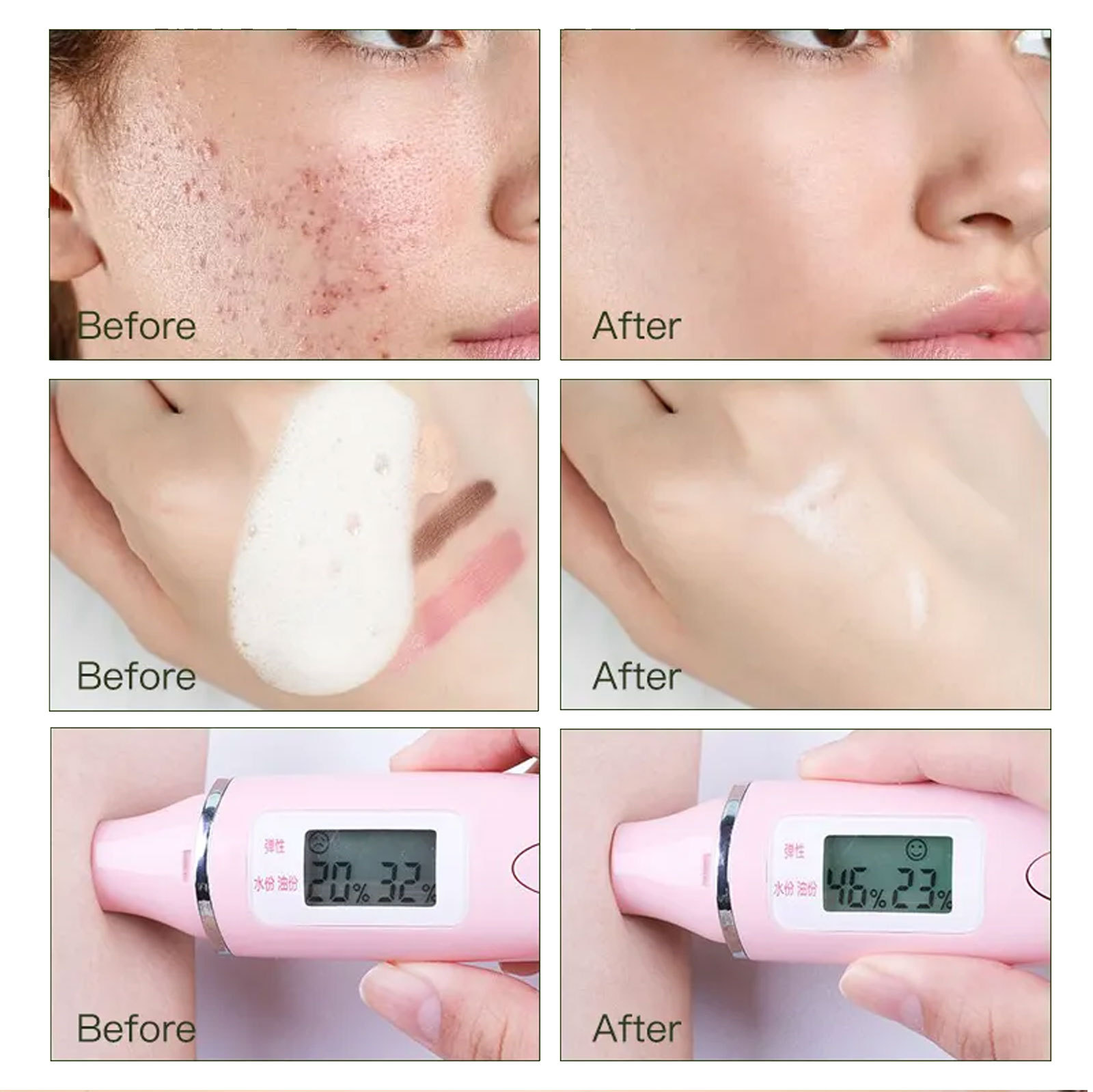 Detergente ialuronico BUPY schiuma Detergente viso Struccante Pulizia Controllo olio Mousse idratante_voghion.com