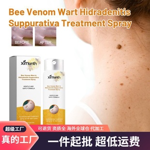 XIMONTH Bee Venom Cloth Care Spray Skin Cleansing Repair Fade Moles Kerns Body Care Spray