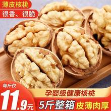 �½���Ƥ������؛��Ƥ������ԭζ�ЋD�Թ���ʳ��Ş��
