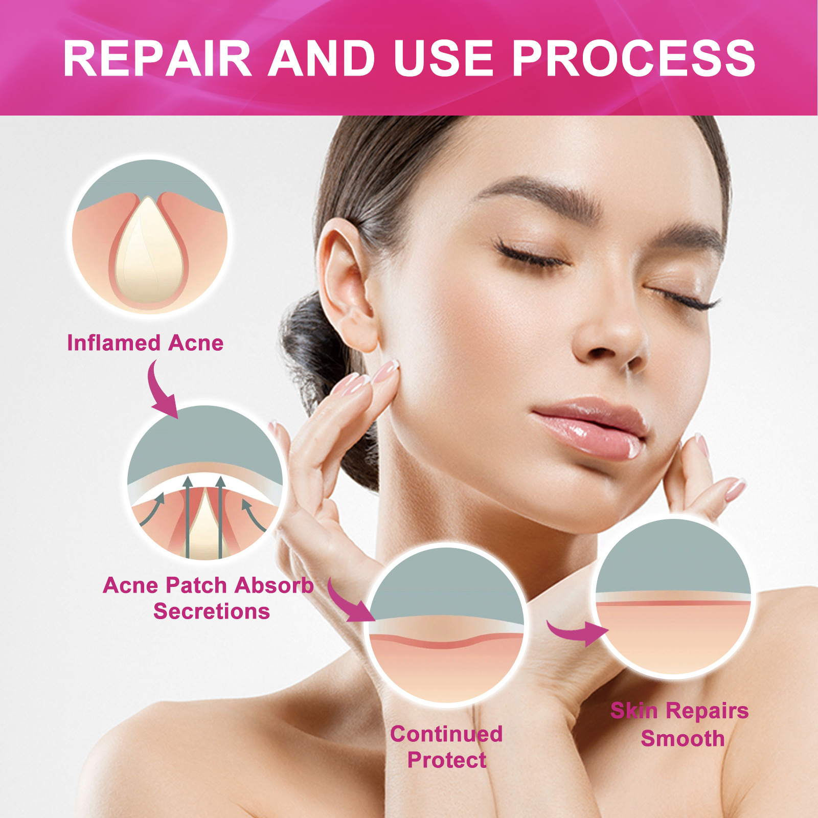 Jayswing Repair Cleaning Pa, atmungsaktiver Concealer, saubere, unsichtbare und transparente Akne-Entfernung_voghion.com