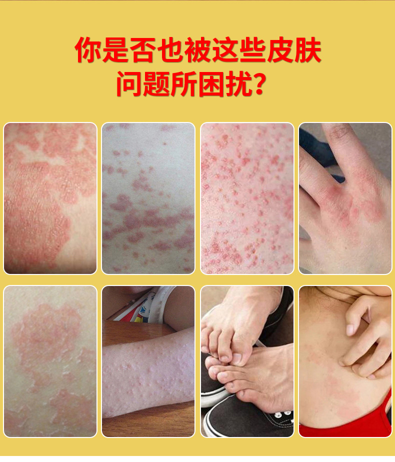 Yao Ben Ren Ba Du Duan Yang Wang Herbal Cream 30g Glass Jar for External Skin Care quality and texture