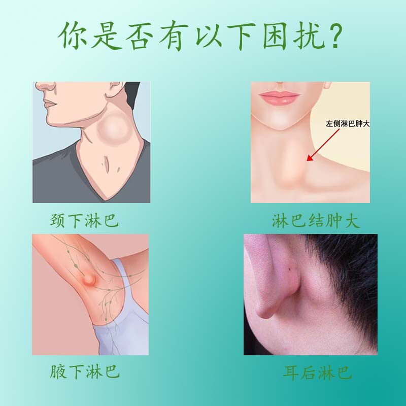 特一のツボの圧力刺激はリンパ型リンパ節の腫れた痛みを貼ってリンパ節の不快なツボを緩和します。|undefined