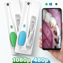 手机口腔牙齿内窥镜高清摄像科观察仪家用护理医检查镜看牙可视镜