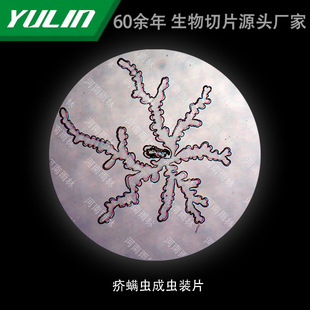 Beacle Mites into Insect Tablets for College Medical Schools, Tissue Disease, Marble Wax Slides, Specimen Microscope