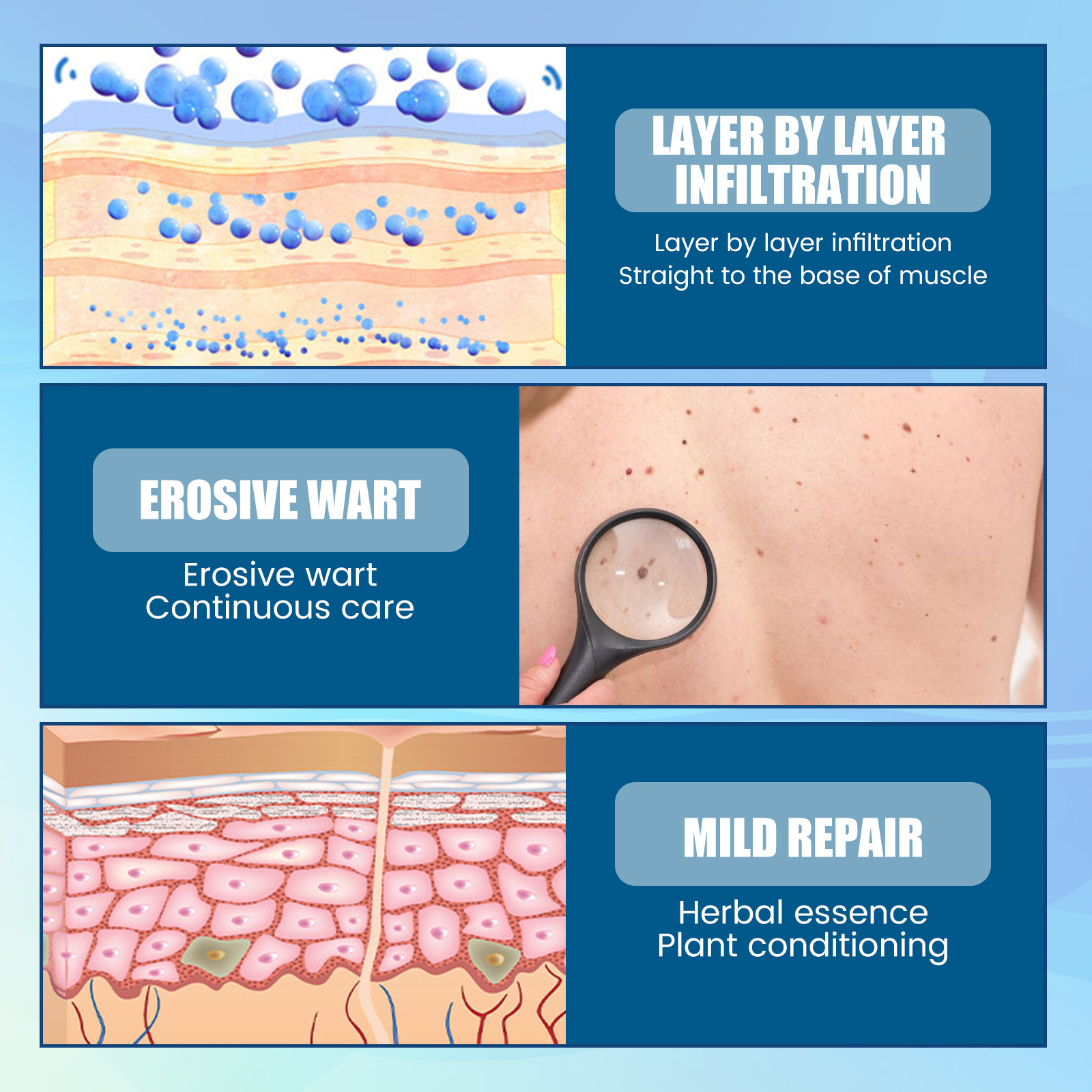 EELHOE Elimineringsplåster för hud Black Memory Curt, Chicken Eyes, Scorpions, Scarless Nevus Cocoon Cleaning and Repair_voghion.com