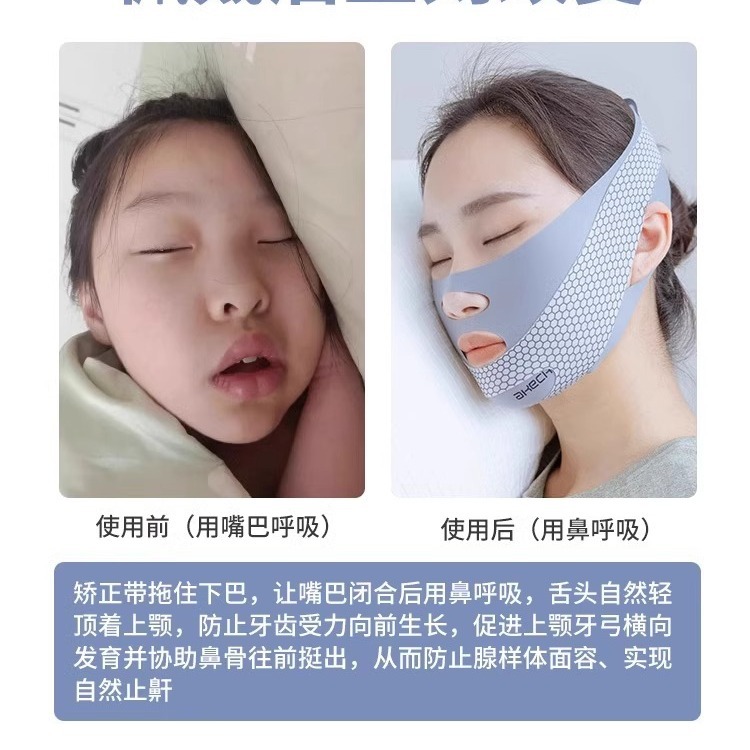 口呼吸矯正器が寝ています。口を開けないでください。神器子供が口を開けていびきをかくのを防ぎます。