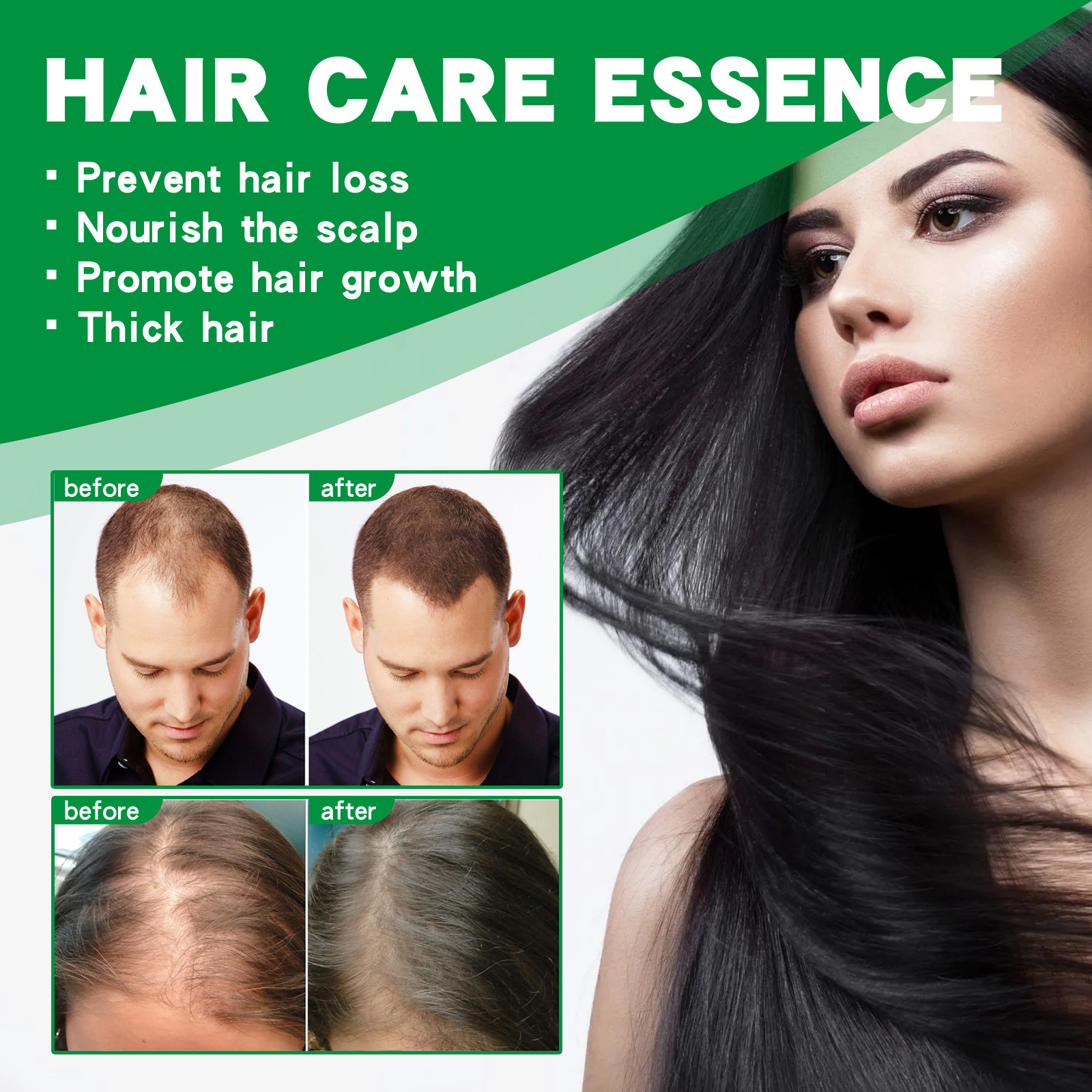 eelhoe Ginger Thick Hair Essence Hair Anti-Fall Firming Hair Roots Thick and Strong Repair Moisturizing Scalp Care_voghion.com