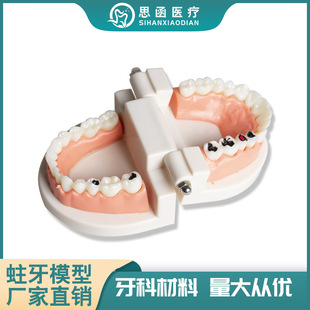 Tooth decay model tooth model tooth decay interpretation model infant teaching model theory model