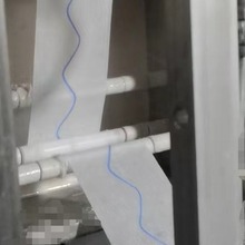 ����һ���Ԍ���ֹѪ�����ۯB�C X���@Ӱ�����ۙC �o�����O��S��