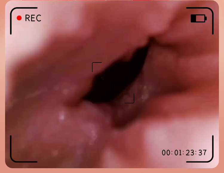 Jiuai Half-Body Male Masturbator with Vagina and Buttocks, TPE, Vibration, Skin Tone — detail image 9