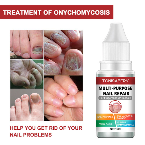 10ml Special Repair Solution for Onychomycosis Hand and Foot Care Nourishing Repair Solution Moisturizing Smoothing Nail Polishing Solution