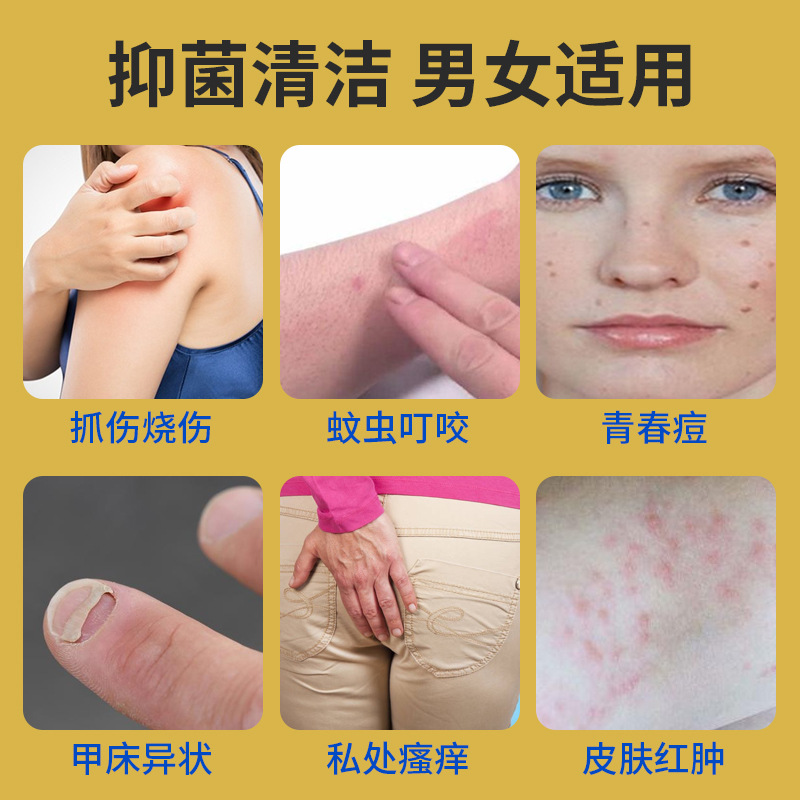 臭氧油生產廠家臭氧原油皮膚抑菌液臭氧凝膠三氧化油臭氧精油批發