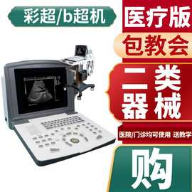 数码电子阴道镜 妇科诊断设备高清系统阴道筛查仪器设备生产厂家