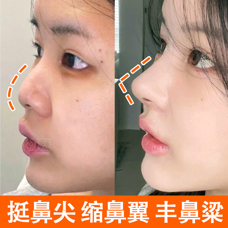 美鼻精油瘦鼻神器挺鼻精油挺拔山根高鼻梁面部精华缩小鼻翼增高液
