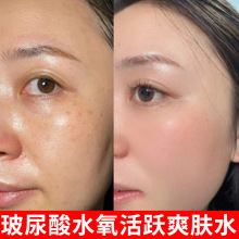 美容院大瓶爽肤水玻尿酸保湿敷小分子精华爽肤化妆水女提亮肤色