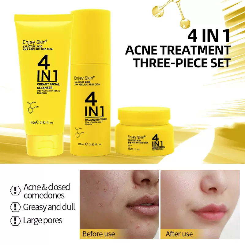 跨境祛痘套盒三件套4合1护肤品套装洗面奶面霜Anti-acne set外贸