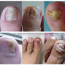 �A���ûҼ��㲿�׺�4��ܛ��Ó�׸�15����Һ20�˸�ל�
