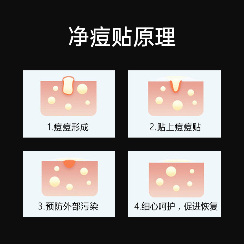 Cute acne patch, (Cross-border trading), conceals acne, Aliexpress