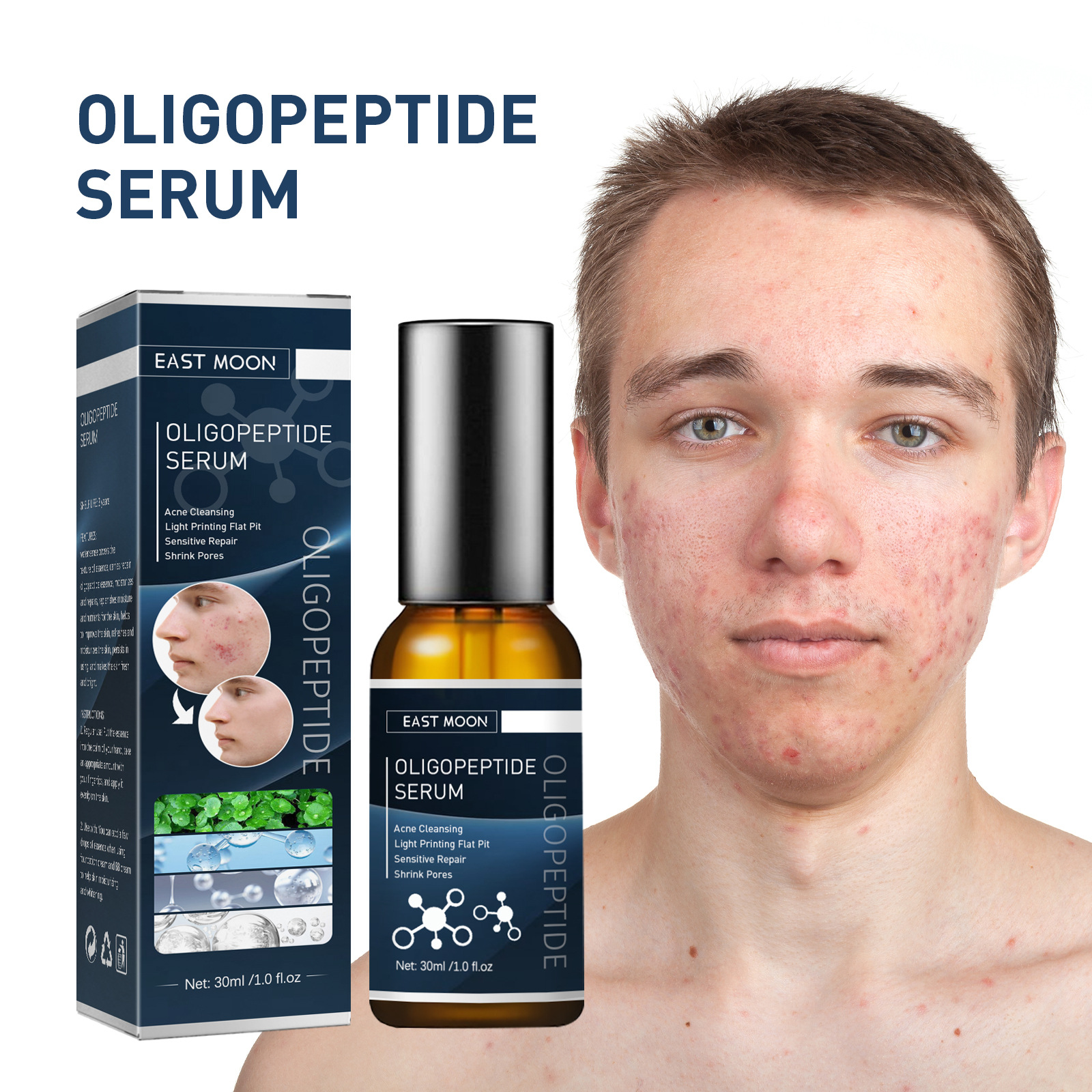 Essenza detergente per l'acne oligopeptidica da uomo: ottieni una pelle più chiara oggi stesso!_voghion.com