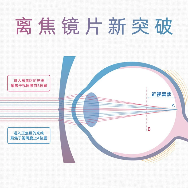 Double-sided lens, glasses, 591pcs, for teenagers