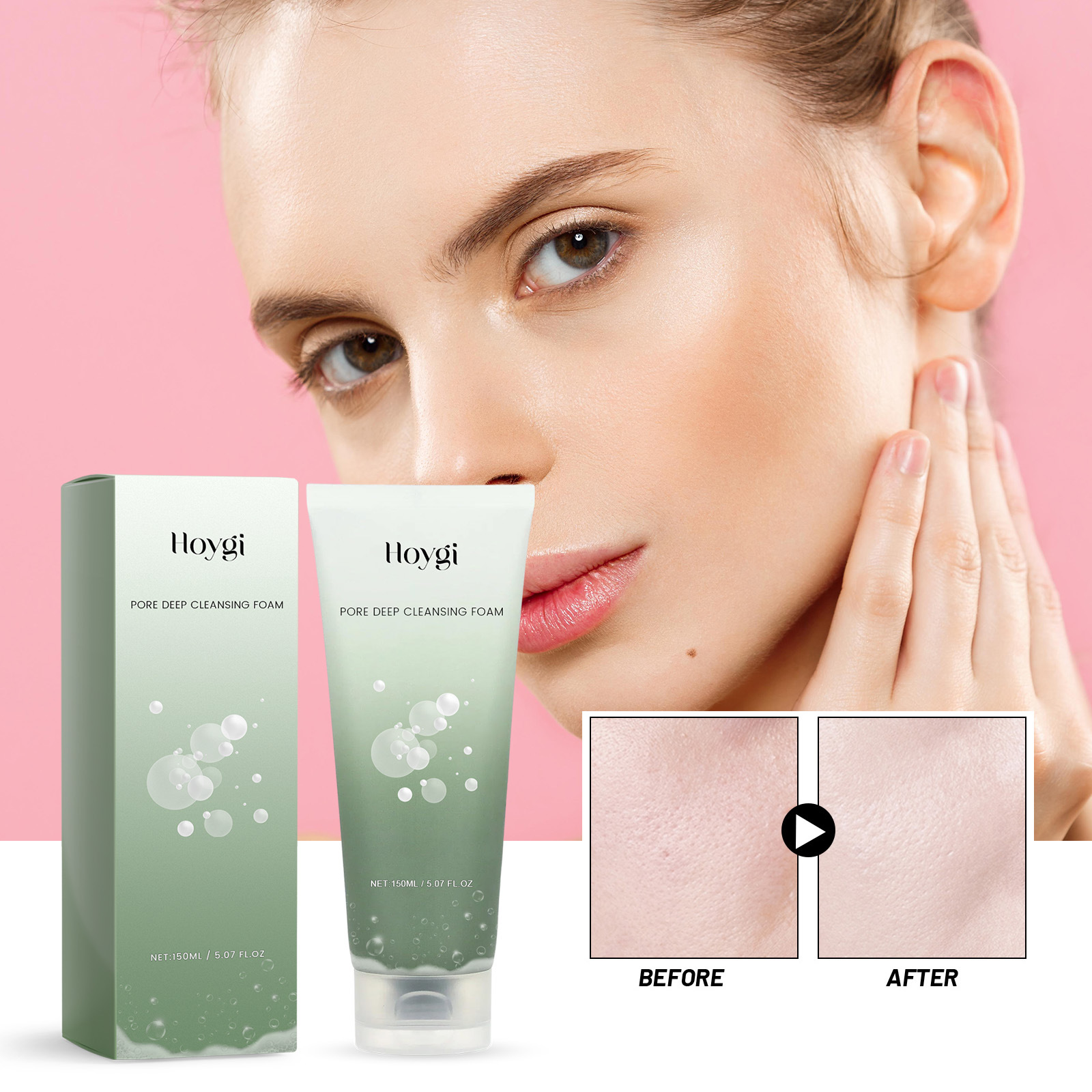 Le nettoyant nettoyant pour pores Hoygi illumine la peau du visage, nettoie en profondeur les marques d'acné, nettoie, hydrate et hydrate_voghion.com